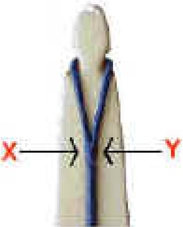 archer de beauchamp boucle